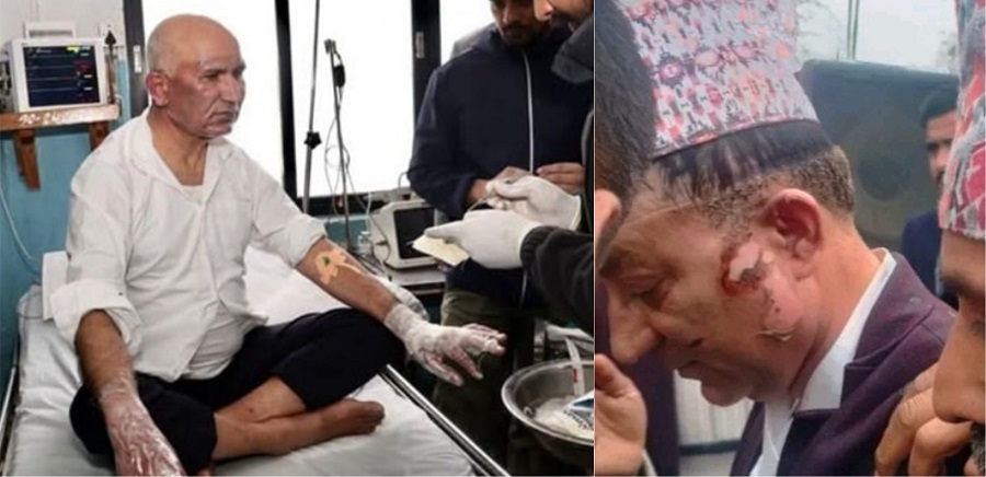 अर्थमन्त्री पौडेल अस्पतालबाट डिस्चार्ज, मेयर आचार्यको थप उपचार हुने